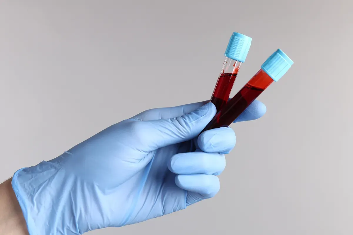 Blood in Urine vs. Menstruation