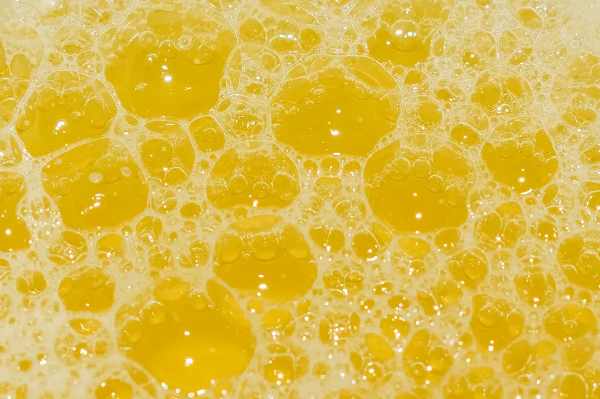 Bubbling or Foamy Urine: A Sign of Kidney Disease or Poor Kidney Health?