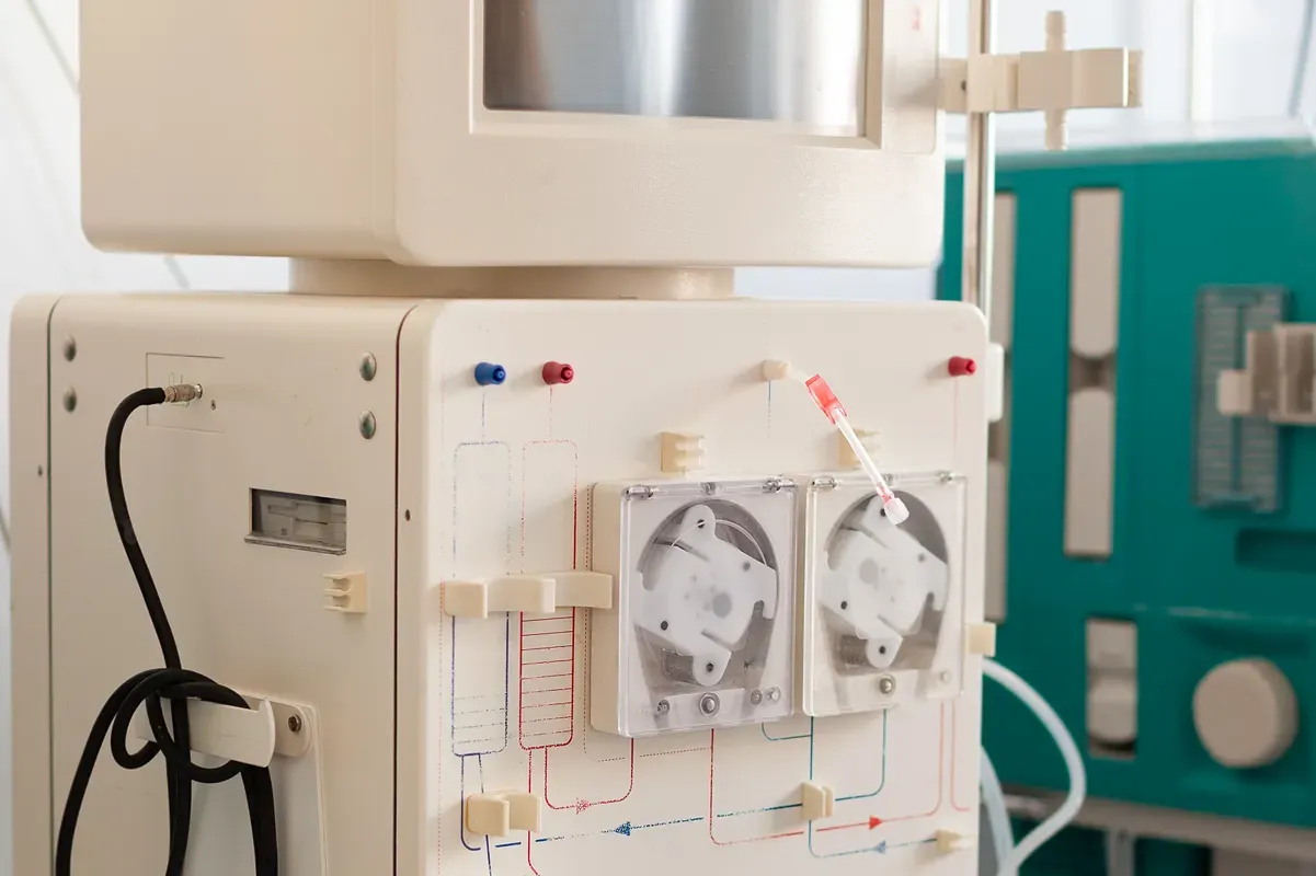 Common Complications of Dialysis and How to Manage Them