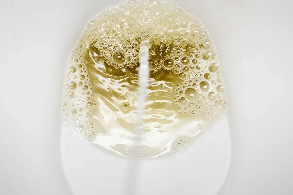 Bubbly or Foamy Urine: Is it a Sign of Kidney Disease?