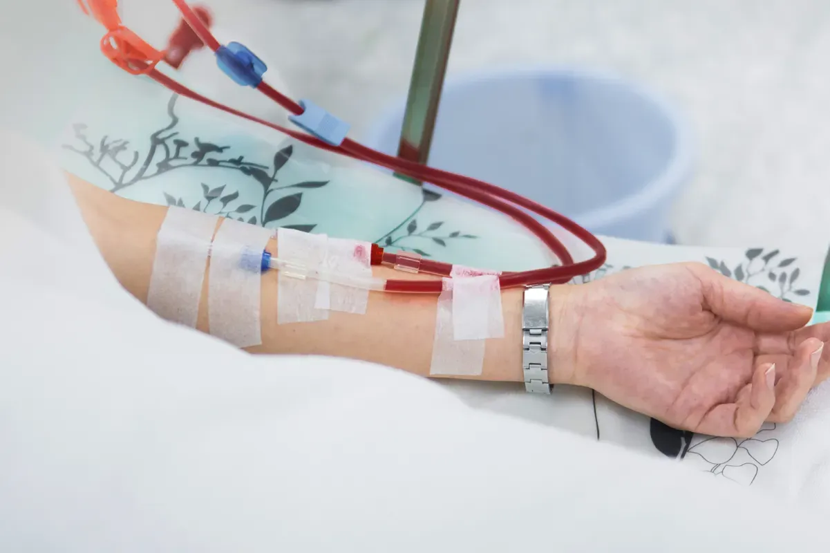 How Haemodialysis Affects Long-Term Health