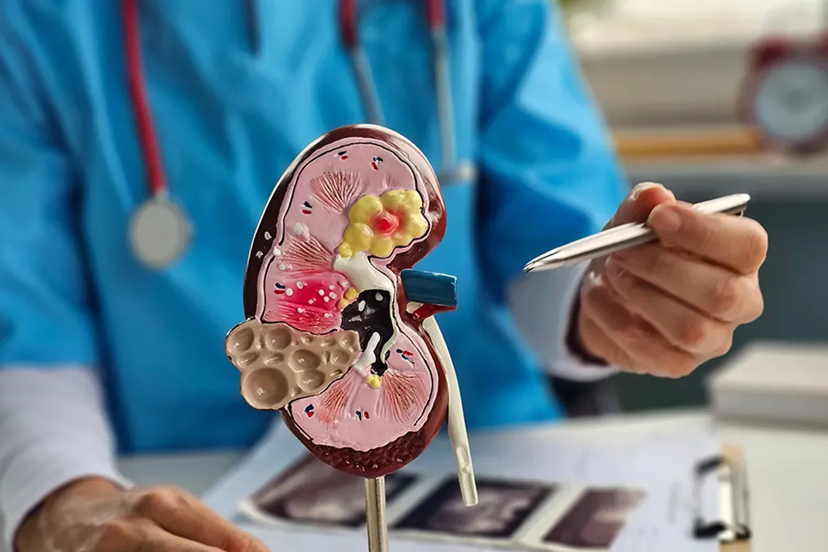 How Diabetes Affects Your Kidneys Over Time