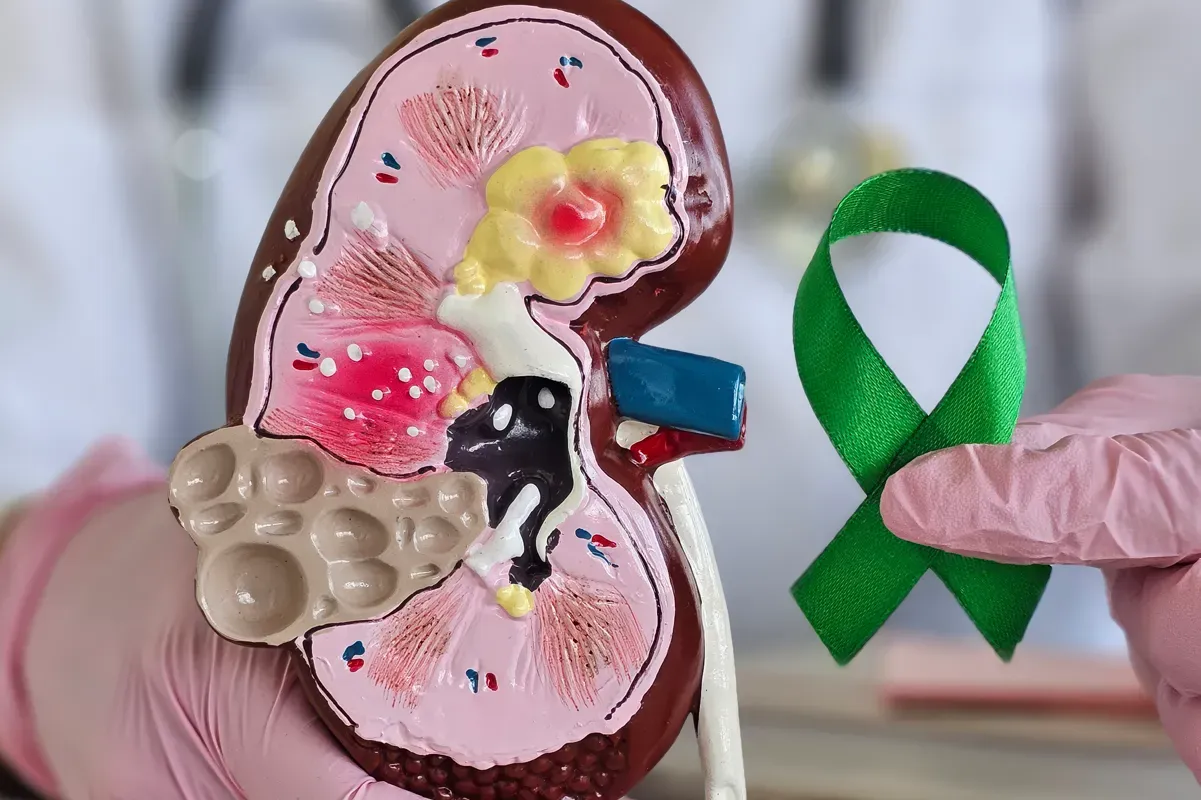 Preventing Acute Kidney Injury: Lifestyle Changes and Tips for Kidney Health