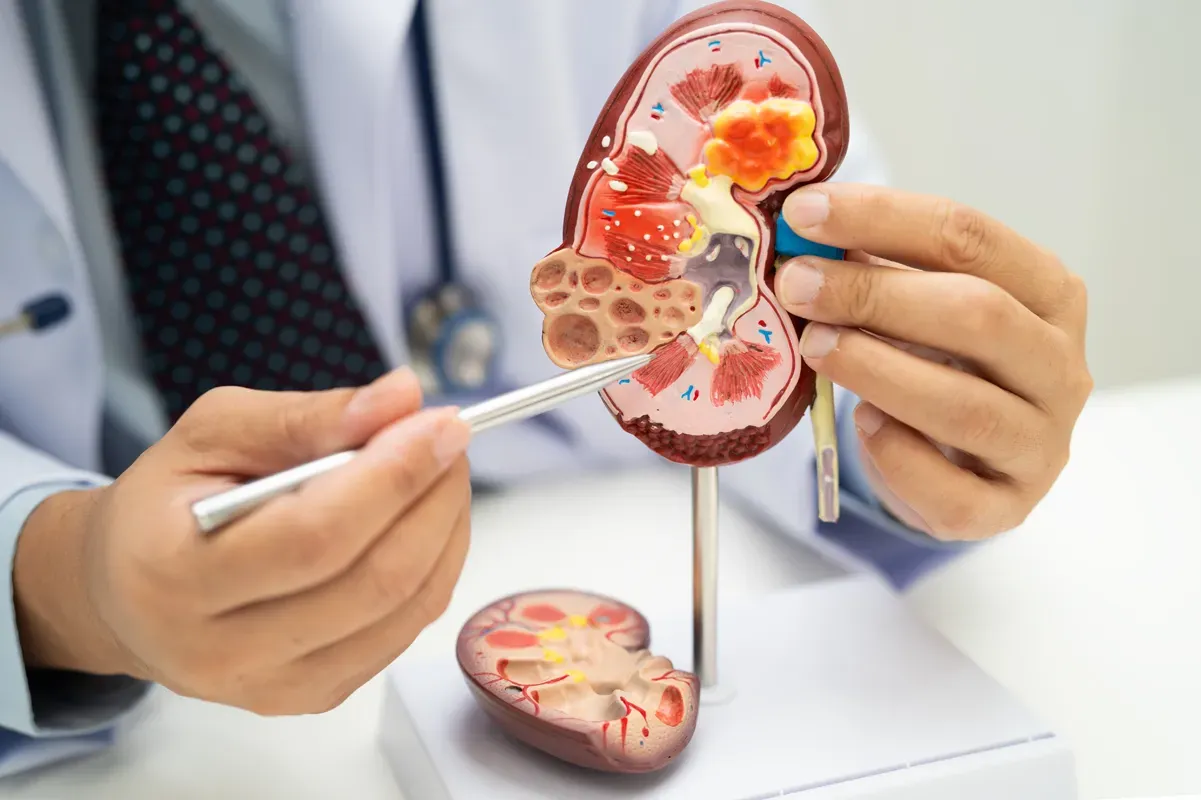 Recognising Chronic Kidney Disease (CKD) Symptoms: Early Detection