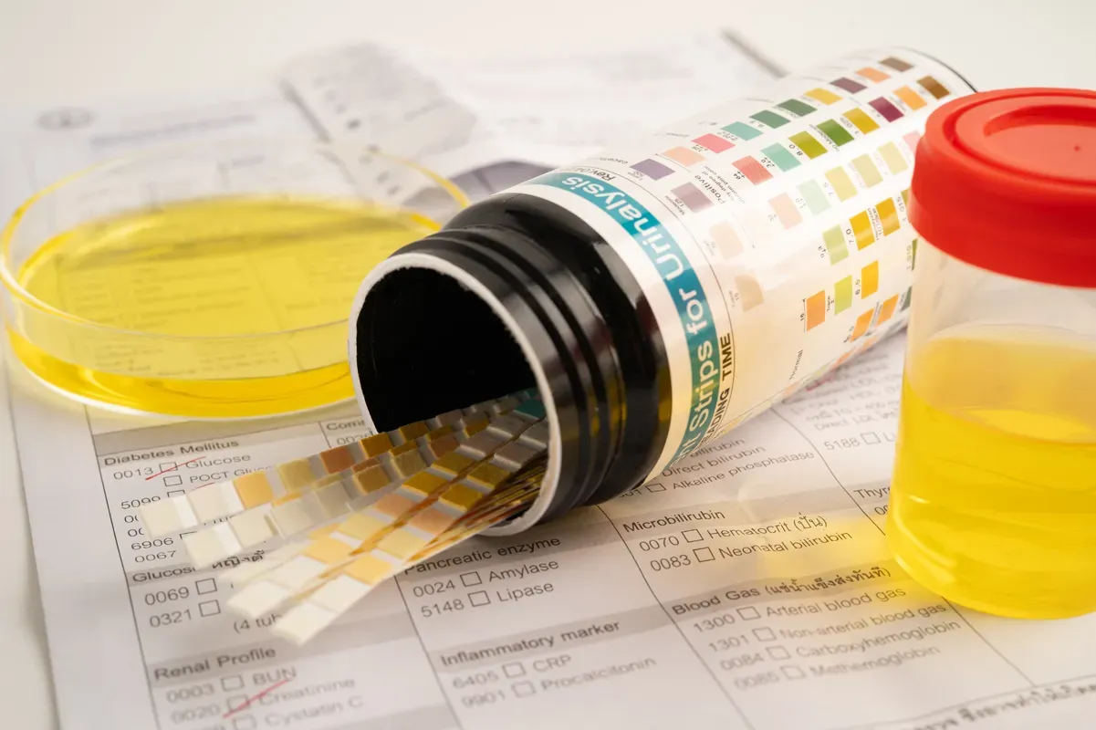 Understanding Glomerulonephritis Symptoms and Treatments