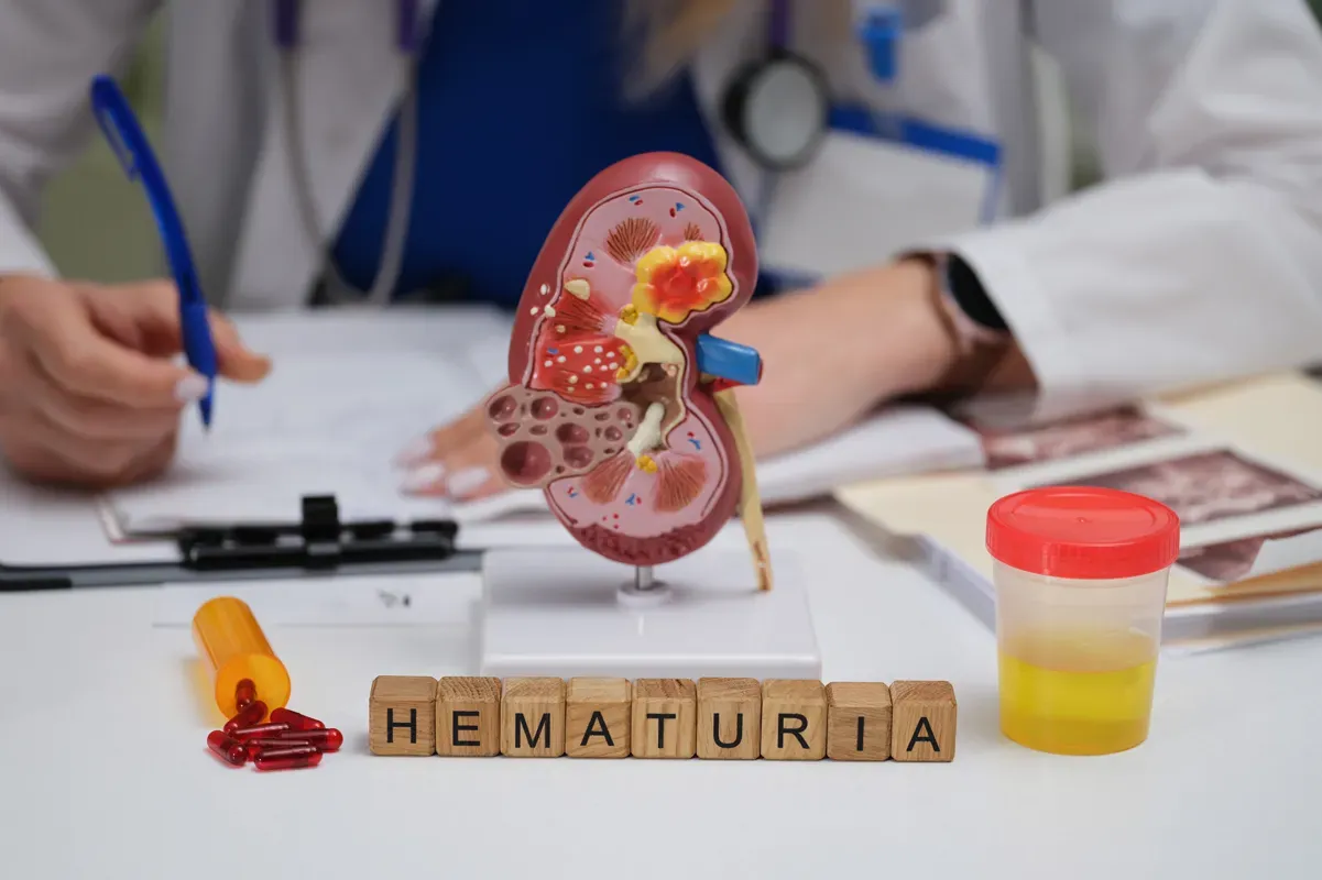 Preventing Blood in Urine (also known as Haematuria)