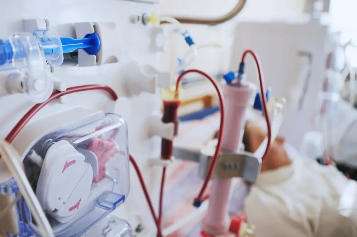 Understanding Kidney Failure: Role of Dialysis Treatment Option