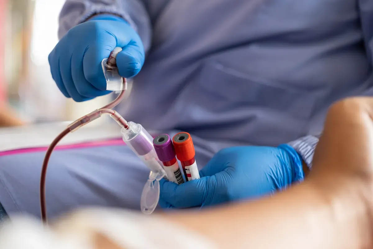 When and How to Get Tested at a Kidney Clinic